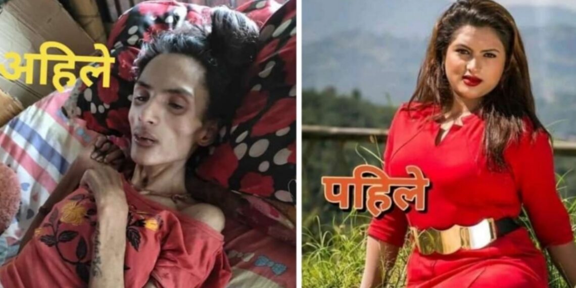 आर्थिक सहयोग गरिदिन निशाका पिताको अपिल